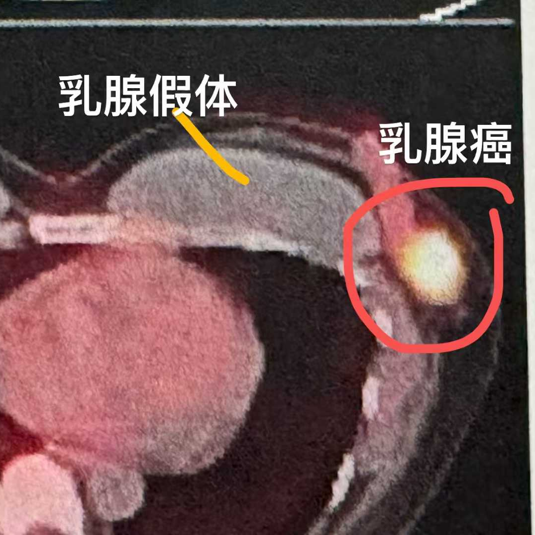 97a60aee27926bd372936aee95957c8f.jpg 97a60aee27926bd372936aee95957c8f.jpg