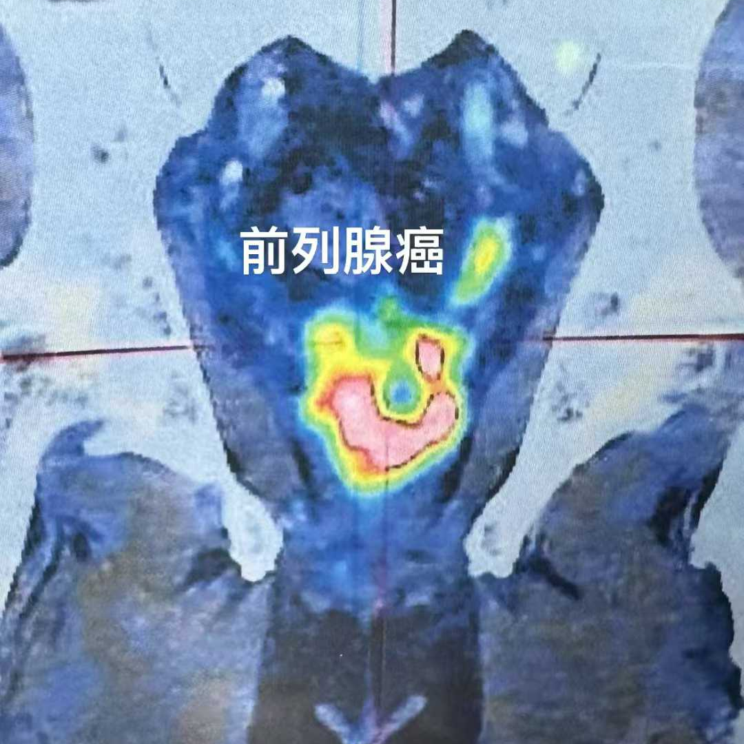 anon28_836255.jpg b12.jpg