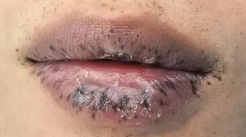 4e452af8c1c611e142a961de46b564f4.jpg 4e452af8c1c611e142a961de46b564f4.jpg