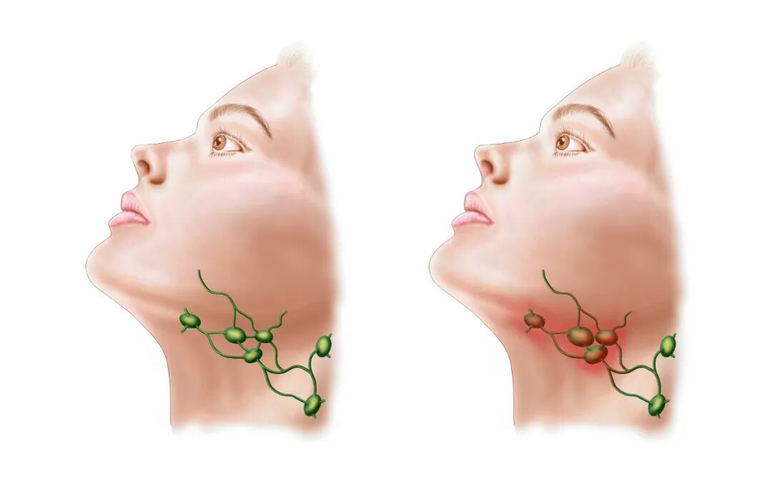 STK700230H.jpg